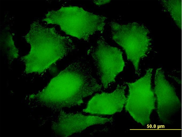Immunofluorescence of monoclonal antibody to ARD1A on HeLa cell. [antibody concentration 10 ug/ml]