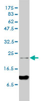 ARD1 monoclonal antibody (M01), clone 4B7-H4 Western Blot analysis of ARD1 expression in HeLa NE.