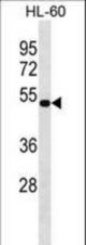 NAAA Antibody western blot of HL-60 cell line lysates (35 ug/lane). The NAAA antibody detected the NAAA protein (arrow).