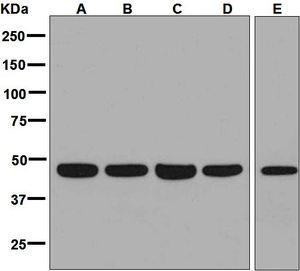 Western blot analysis on (A) HeLa, (B) K562, (C) U87-MG, (D) HepG2, and (E) fetal brain lysates using anti-MC5 Receptor antibody.