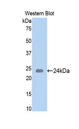 Western blot of recombinant NAGA.