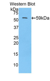 Western blot of recombinant NAGLU.