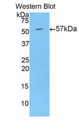 Western blot of recombinant NAGLU.