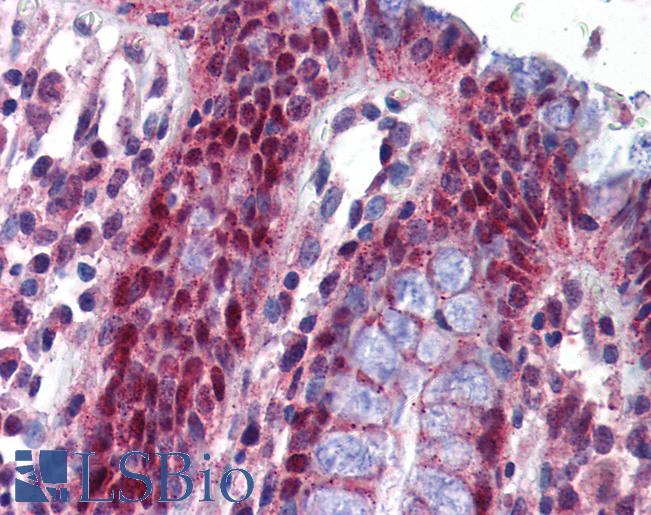 Anti-NLRP1 / NALP1 antibody IHC of human colon. Immunohistochemistry of formalin-fixed, paraffin-embedded tissue after heat-induced antigen retrieval. Antibody LS-B5845 concentration 5 ug/ml.