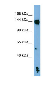 NLRP1 / NALP1 antibody LS-B5845 Western blot of NCI-H226 cell lysate.