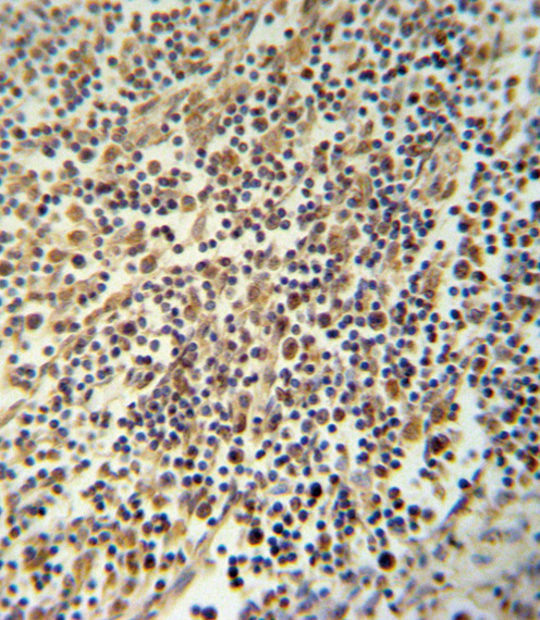 NLRP3 Antibody immunohistochemistry of formalin-fixed and paraffin-embedded human lymph tissue followed by peroxidase-conjugated secondary antibody and DAB staining.