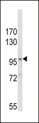 Western blot of NLRP3 Antibody in MDA-MB231 cell line lysates (35 ug/lane). NLRP3 (arrow) was detected using the purified antibody.