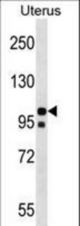 NLRP4 Antibody western blot of Uterus tissue lysates (35 ug/lane). The NLRP4 antibody detected the NLRP4 protein (arrow).