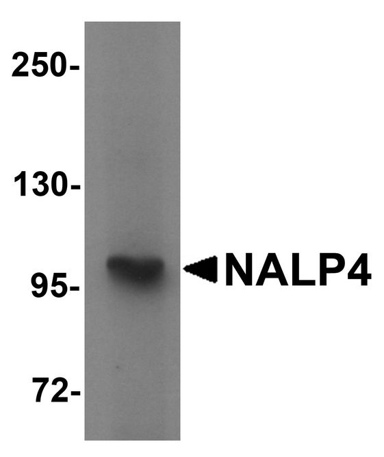 Western blot analysis of NALP4 in K562 cell lysate with NALP4 antibody at 1 ug/ml.