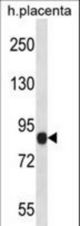 NLRP6Antibody western blot of human placenta tissue lysates (35 ug/lane). The NLRP6 antibody detected the NLRP6 protein (arrow).