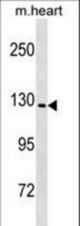 Mouse Nlrp6 Antibody western blot of mouse heart tissue lysates (35 ug/lane). The Nlrp6 antibody detected the Nlrp6 protein (arrow).