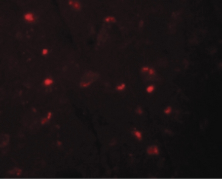 Immunofluorescence of NALP6 in human brain tissue with NALP6 antibody at 20 ug/ml.