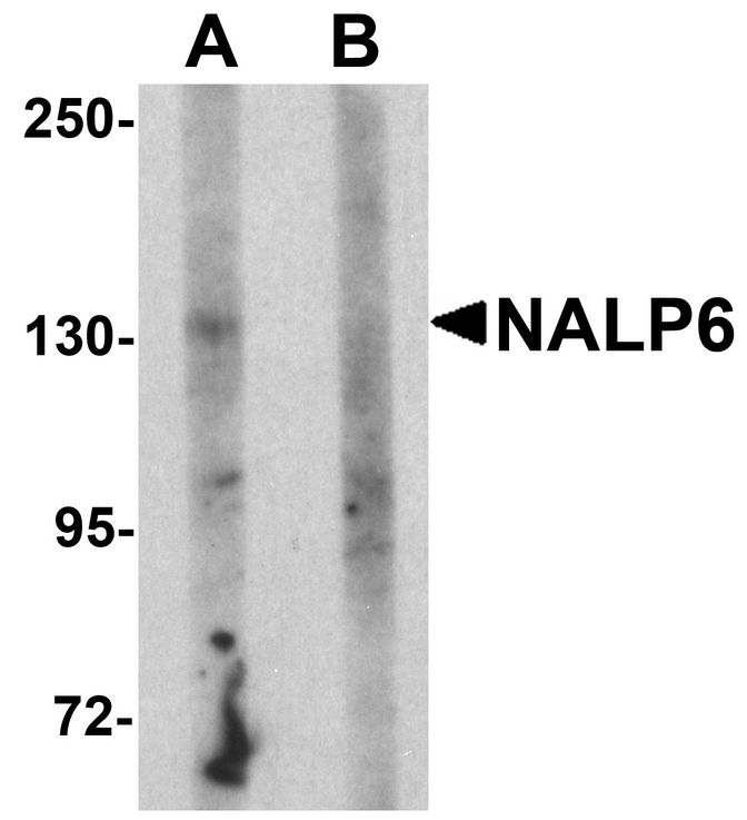 Western blot analysis of NALP5 in mouse brain tissue lysate with NALP5 antibody at 1 ug/ml in (A) the absence and (B) the presence of blocking peptide.