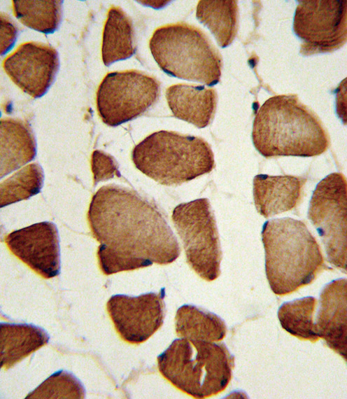 Formalin-fixed and paraffin-embedded human skeletal muscle reacted with NAMPT Antibody , which was peroxidase-conjugated to the secondary antibody, followed by DAB staining. This data demonstrates the use of this antibody for immunohistochemistry; clinical relevance has not been evaluated.