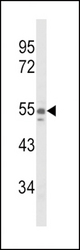 Western blot of NAMPT Antibody in A375 cell line lysates (35 ug/lane). NAMPT (arrow) was detected using the purified antibody.