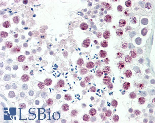 Human, Testis: Formalin-Fixed Paraffin-Embedded (FFPE)