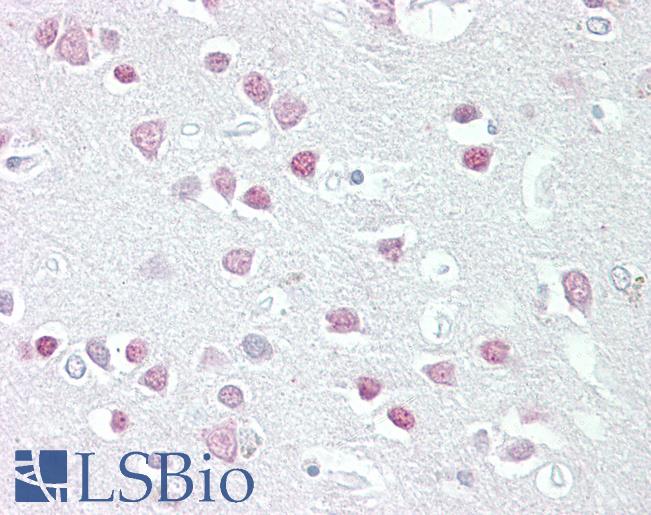 Anti-MC5 Receptor antibody IHC of human brain, cortex. Immunohistochemistry of formalin-fixed, paraffin-embedded tissue after heat-induced antigen retrieval. Antibody LS-B6471 concentration 2.5 ug/ml.