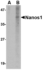 Western blot of Nanos1 in SK-N-SH cell lysate with Nanos1 antibody at 1 ug/ml in (A) the presence and (B) the absence of blocking peptide.