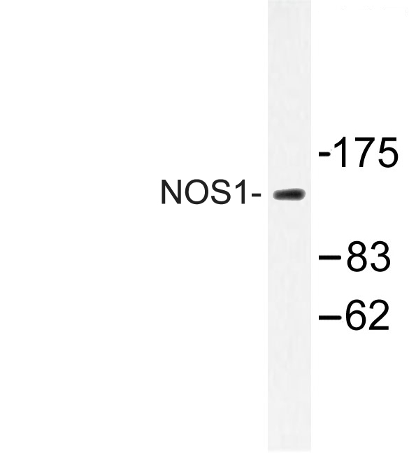 Western blot of NOS1 (Y846) pAb in extracts from A549 cells.