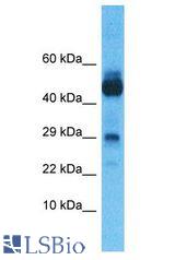 NANOS1 / NOS1 antibody Western Blot of Thymus Tumor. Antibody dilution: 1 ug/ml.