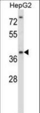 NANOS1 Antibody western blot of HepG2 cell line lysates (35 ug/lane). The NANOS1 antibody detected the NANOS1 protein (arrow).