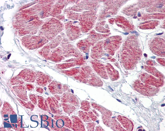 Anti-NANOS1 antibody IHC of human heart. Immunohistochemistry of formalin-fixed, paraffin-embedded tissue after heat-induced antigen retrieval. Antibody LS-B7242 concentration 5 ug/ml.