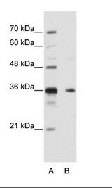 B: HepG2 Cell Lysate