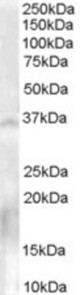 Antibody (0.3 ug/ml) staining of Human Testis lysate (35 ug protein in RIPA buffer). Primary incubation was 1 hour. Detected by chemiluminescence.