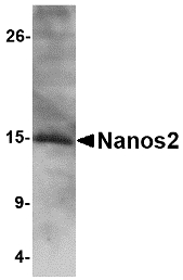 Western blot of Nanos2 in SK-N-SH cell lysate with Nanos2 antibody at 2 ug/ml.