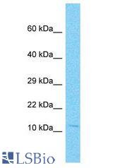 NANOS2 / NOS2 antibody Western Blot of Jurkat. Antibody dilution: 1 ug/ml.