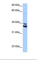 HepG2 cell lysate. Antibody concentration: 1.0 ug/ml. Gel concentration: 12%.