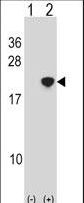 Western blot of NANOS2 (arrow) using rabbit polyclonal NANOS2 Antibody. 293 cell lysates (2 ug/lane) either nontransfected (Lane 1) or transiently transfected (Lane 2) with the NANOS2 gene.