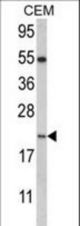 Western blot of NANOS2 Antibody in CEM cell line lysates (35 ug/lane). NANOS2 (arrow) was detected using the purified antibody.