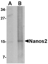 Western blot of Nanos2 in rat brain tissue lysate with Nanos2 antibody at (A) 1 and (B) 2 ug/ml.