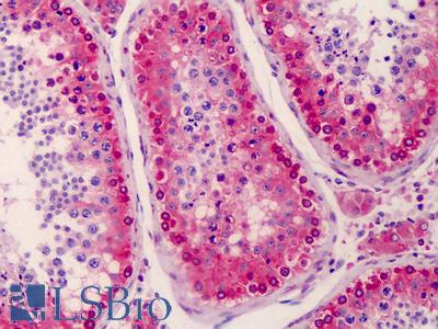 Anti-NANOS3 antibody IHC of human testis. Immunohistochemistry of formalin-fixed, paraffin-embedded tissue after heat-induced antigen retrieval. Antibody LS-B4983 concentration 5 ug/ml.