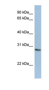 NANP antibody LS-C111472 Western blot of Jurkat lysate.