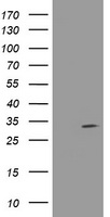 HEK293T cells were transfected with the pCMV6-ENTRY control (Left lane) or pCMV6-ENTRY NANP (Right lane) cDNA for 48 hrs and lysed. Equivalent amounts of cell lysates (5 ug per lane) were separated by SDS-PAGE and immunoblotted with anti-NANP.