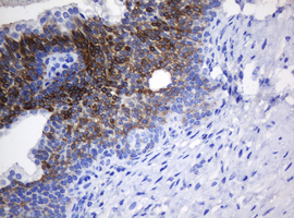 IHC of paraffin-embedded Human prostate tissue using anti-NANP mouse monoclonal antibody.