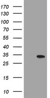 HEK293T cells were transfected with the pCMV6-ENTRY control (Left lane) or pCMV6-ENTRY NANP (Right lane) cDNA for 48 hrs and lysed. Equivalent amounts of cell lysates (5 ug per lane) were separated by SDS-PAGE and immunoblotted with anti-NANP.