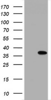 HEK293T cells were transfected with the pCMV6-ENTRY control (Left lane) or pCMV6-ENTRY NANP (Right lane) cDNA for 48 hrs and lysed. Equivalent amounts of cell lysates (5 ug per lane) were separated by SDS-PAGE and immunoblotted with anti-NANP.