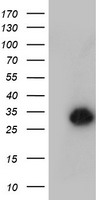 HEK293T cells were transfected with the pCMV6-ENTRY control (Left lane) or pCMV6-ENTRY NANP (Right lane) cDNA for 48 hrs and lysed. Equivalent amounts of cell lysates (5 ug per lane) were separated by SDS-PAGE and immunoblotted with anti-NANP.