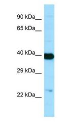 NANS antibody Western Blot of Human brain.