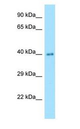 NANS antibody Western Blot of Human Lung.