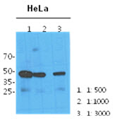 Western Blot: The cell lysates (40 ug) were resolved by SDS-PAGE, transferred to PVDF membrane and probed with anti-human NANS antibody (1:100, 1:1000, 1:3000). Proteins were visualized using a goat anti-mouse secondary antibody conjugated to HRP and an ECL detection system.