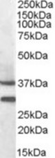 MC5R antibody (0.3 ug/ml) staining of Mouse Muscle lysate (35 ug protein/ml in RIPA buffer). Primary incubation was 1 hour. Detected by chemiluminescence.