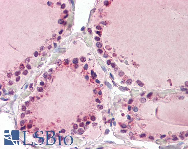 Anti-TAB3 / MAP3K7IP3 antibody IHC of human thyroid. Immunohistochemistry of formalin-fixed, paraffin-embedded tissue after heat-induced antigen retrieval. Antibody LS-B7358 concentration 3.75 ug/ml.