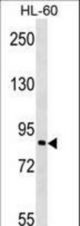 MAP3K7IP3 Antibody western blot of HL-60 cell line lysates (35 ug/lane). The MAP3K7IP3 antibody detected the MAP3K7IP3 protein (arrow).