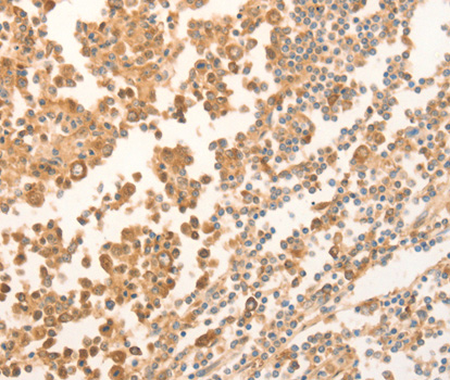 Immunohistochemistry of paraffin-embedded human tonsil tissue using NAP1L1 antibody.