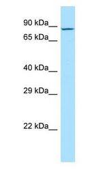 MDGA2 antibody Western Blot of Jurkat.
