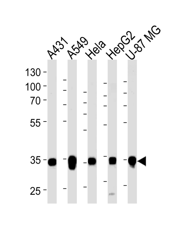 Western blot of lysates from A431, A549, HeLa, HepG2, U-87 MG cell line (from left to right), using MDH2 Antibody. Antibody was diluted at 1:1000 at each lane. A goat anti-rabbit IgG H&L (HRP) at 1:5000 dilution was used as the secondary antibody. Lysates at 35ug per lane.